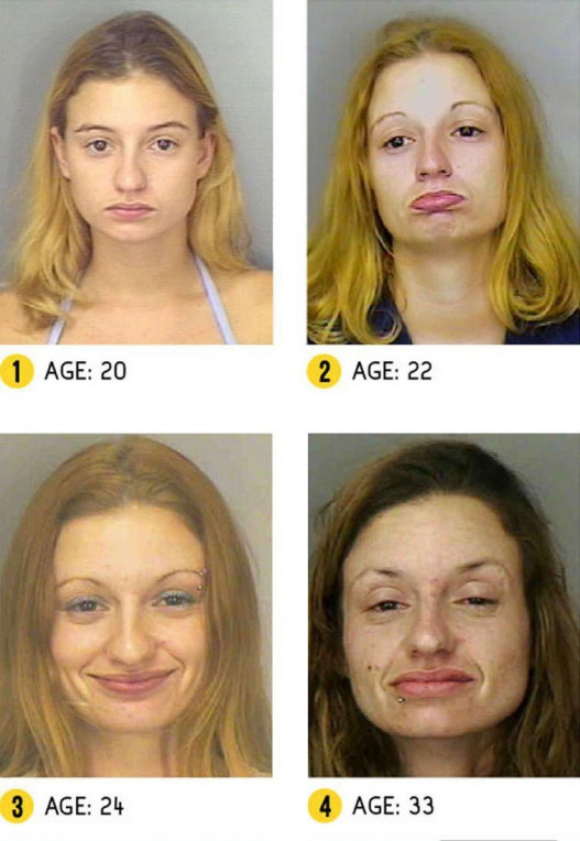 Թմրամոլների աղավաղված դեմքերը` համեմատական լուսանկարներում