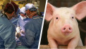 Pig kidney transplanted into living person for first time