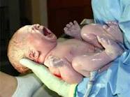 Ինչպես է ծնվում երեխան. բացառիկ նկարահանում (վիդեո)